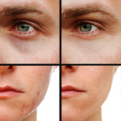 Kode Mens Concealer hides acne scars and blemishes with precise layering.