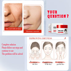 Kojic Acid Cream packaging and product display promoting easy skincare routine.