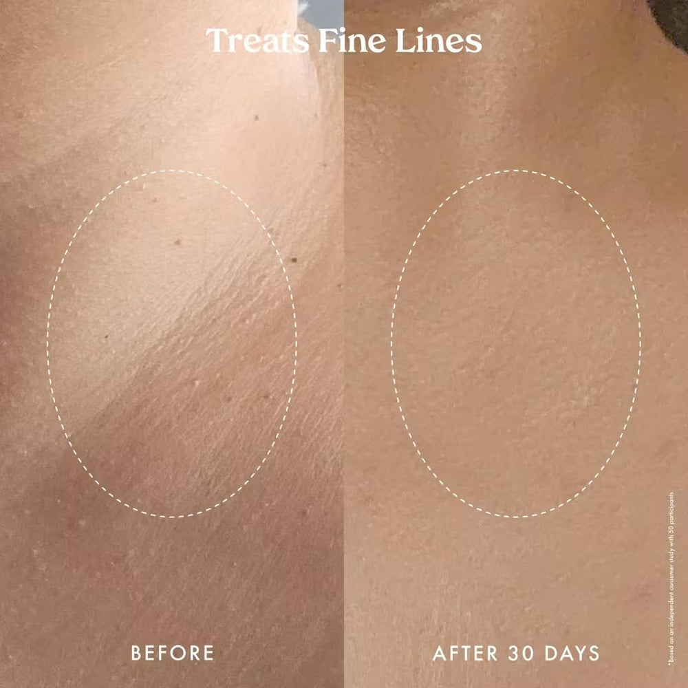 Kopari Ultra Renewal Retinol Body Cream addressing crepey skin on limbs