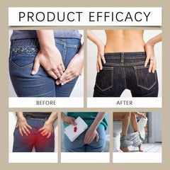 Kunnozz hemorrhoid cream with aloe vera soothing ingredient close-up.