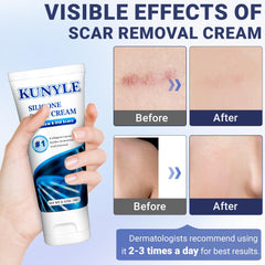 Dispenser cap for easy, mess-free application of Kunyle scar cream