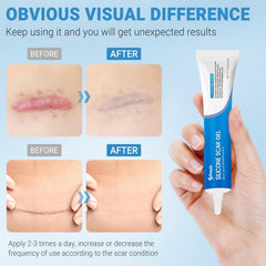 Kunyle scar gel applied in circular motion for even coverage