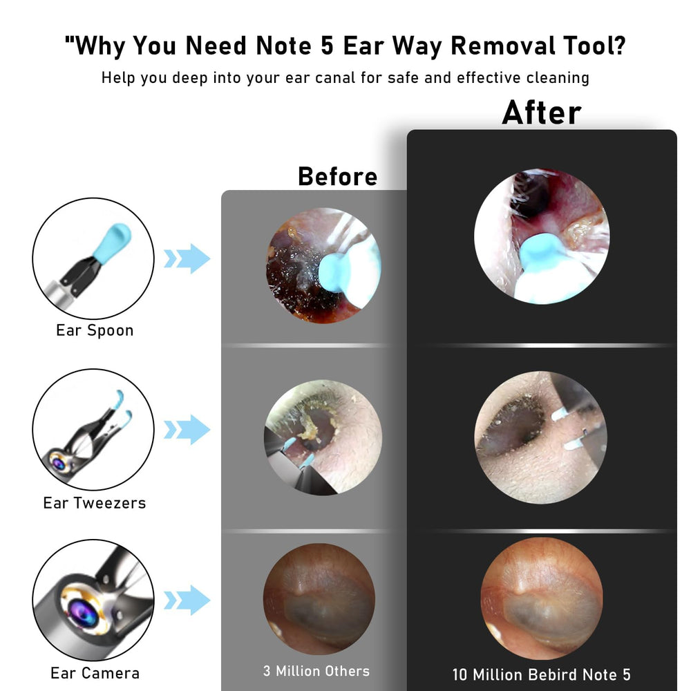 KWYBOW Note5 omni-direction tweezers help lift debris safely.