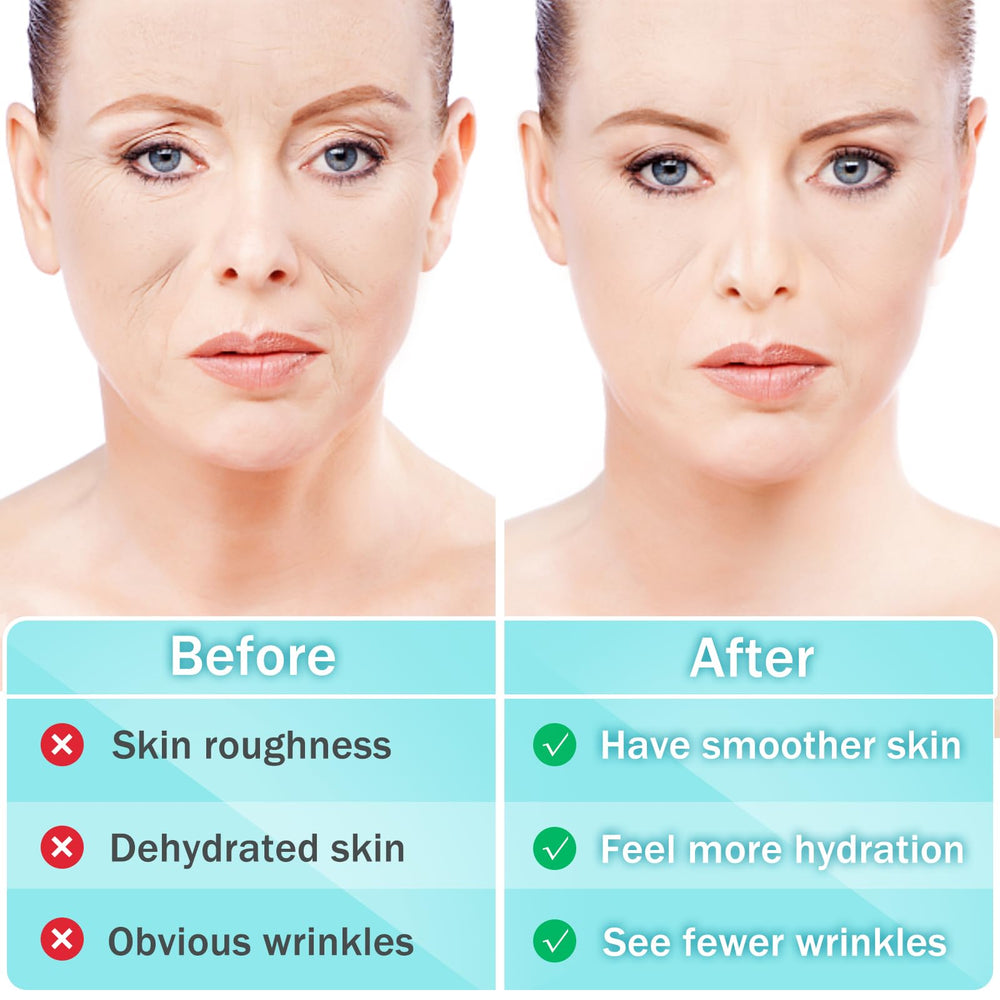 LadPemo frown lines patch targets facial creases for overnight smoothing