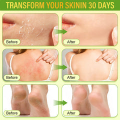 LAITYUM skin nourishment with calendula and honey for sensitive skin