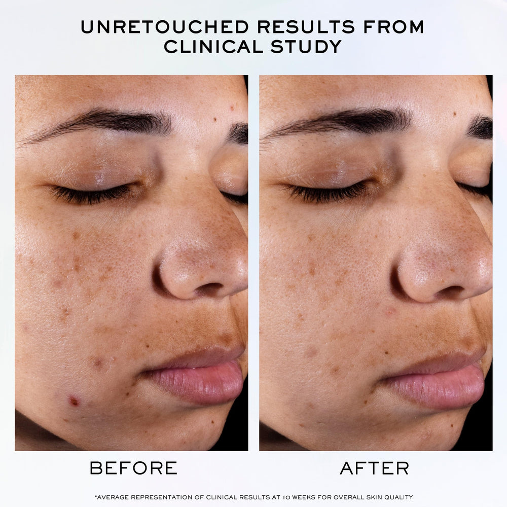 Lancôme Clarifique Pro-Solution ingredients highlight ten-percent PHA and niacinamide.