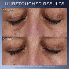 Lancôme Génifique Eye Cream cap close-up highlights precise application control