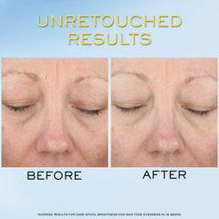 Lancôme Supra Screen application closeup showing invisible serum texture on skin.
