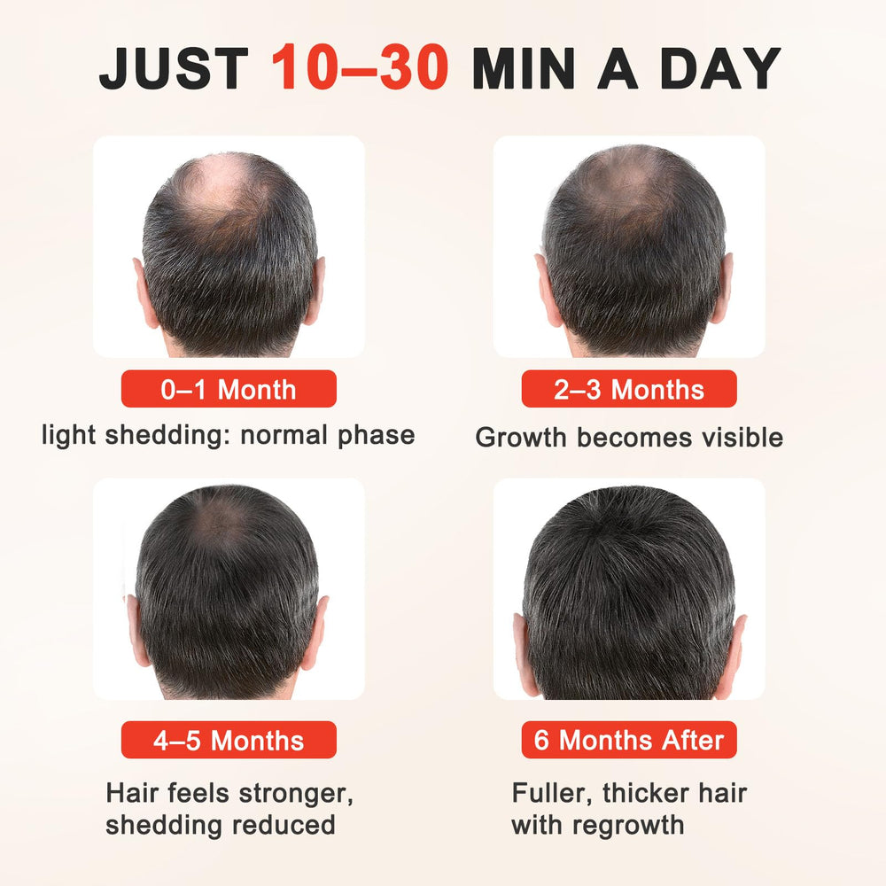 Laser Hair Growth Cap timer display emphasizes precise 20-minute sessions.
