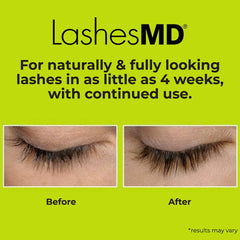 LashesMD lash and brow before-after visual highlights a fuller look