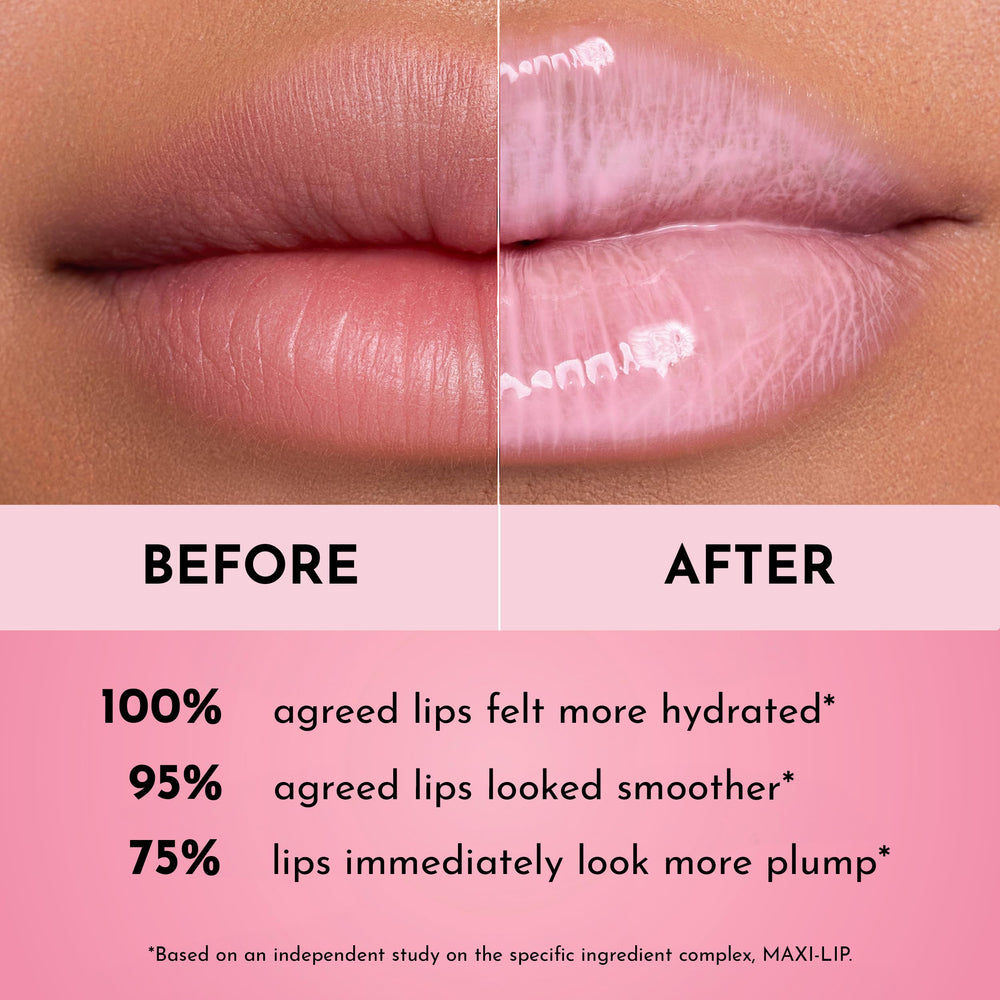 Lawless Forget the Filler gloss close-up shows high shine and plump-looking lips.