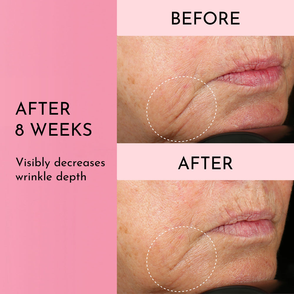 Lawless Forget the Filler final finish delivers radiant skin after application