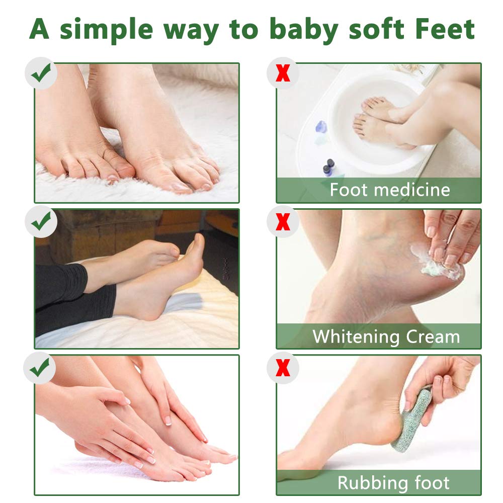 Easy-to-use Liefiet foot mask worn for 50 to 90 minutes at home.