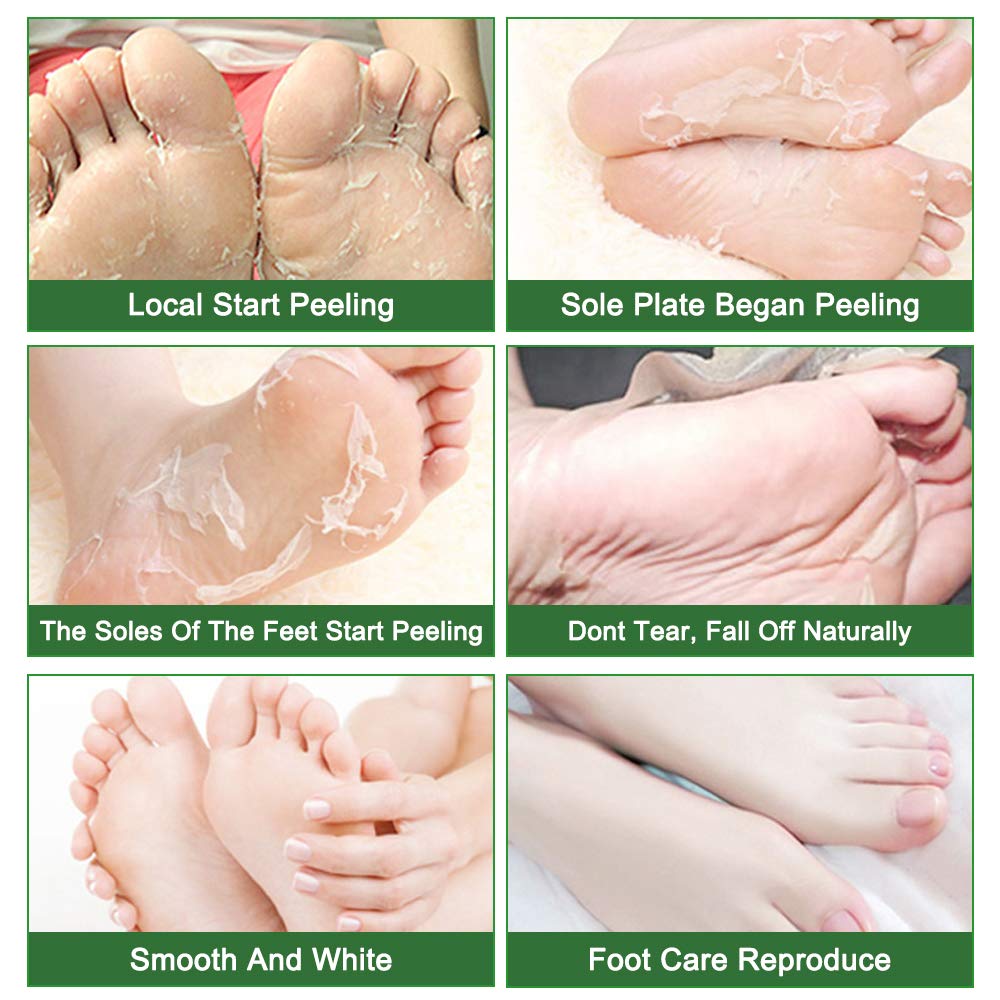Liefiet lavender-infused foot mask delivering nourishing hydration to dry skin.