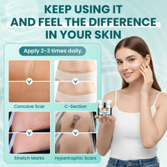 Lipend vitamin E enriched formula nourishes skin for scar softness