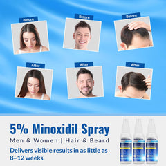 Listarfe 5% Minoxidil spray for women hair growth supports regrowth