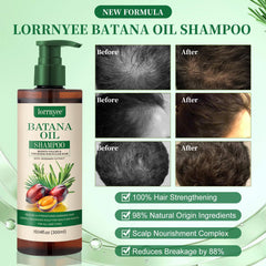Lorrnyee Rosemary extract shampoo bottle highlights natural cleansing