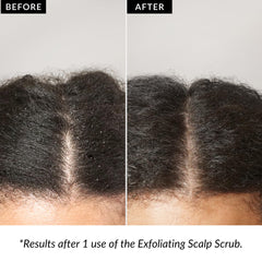 Love Ur Curls Exfoliating Scalp Scrub designed for pre-shampoo use with an applicator.