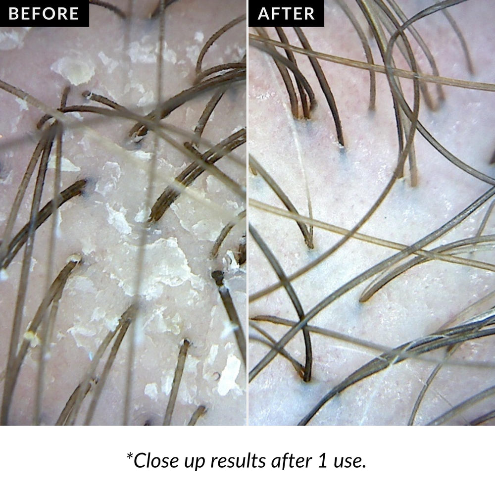 Love Ur Curls Exfoliating Scalp Scrub uses volcanic ash to exfoliate gently.