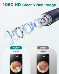 Loyker 6 LED light illuminates the canal for precise removal.