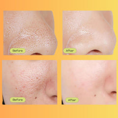 Luelle Witch Hazel and Centella ingredients highlight pore balance and calming effects