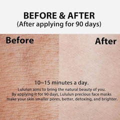 Lululun 32EA anti-aging mask supports even skin tone.