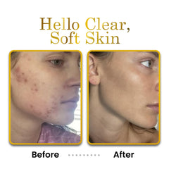 LUXEBEAUTY hyaluronic acid glow concept illustrating hydration boost.