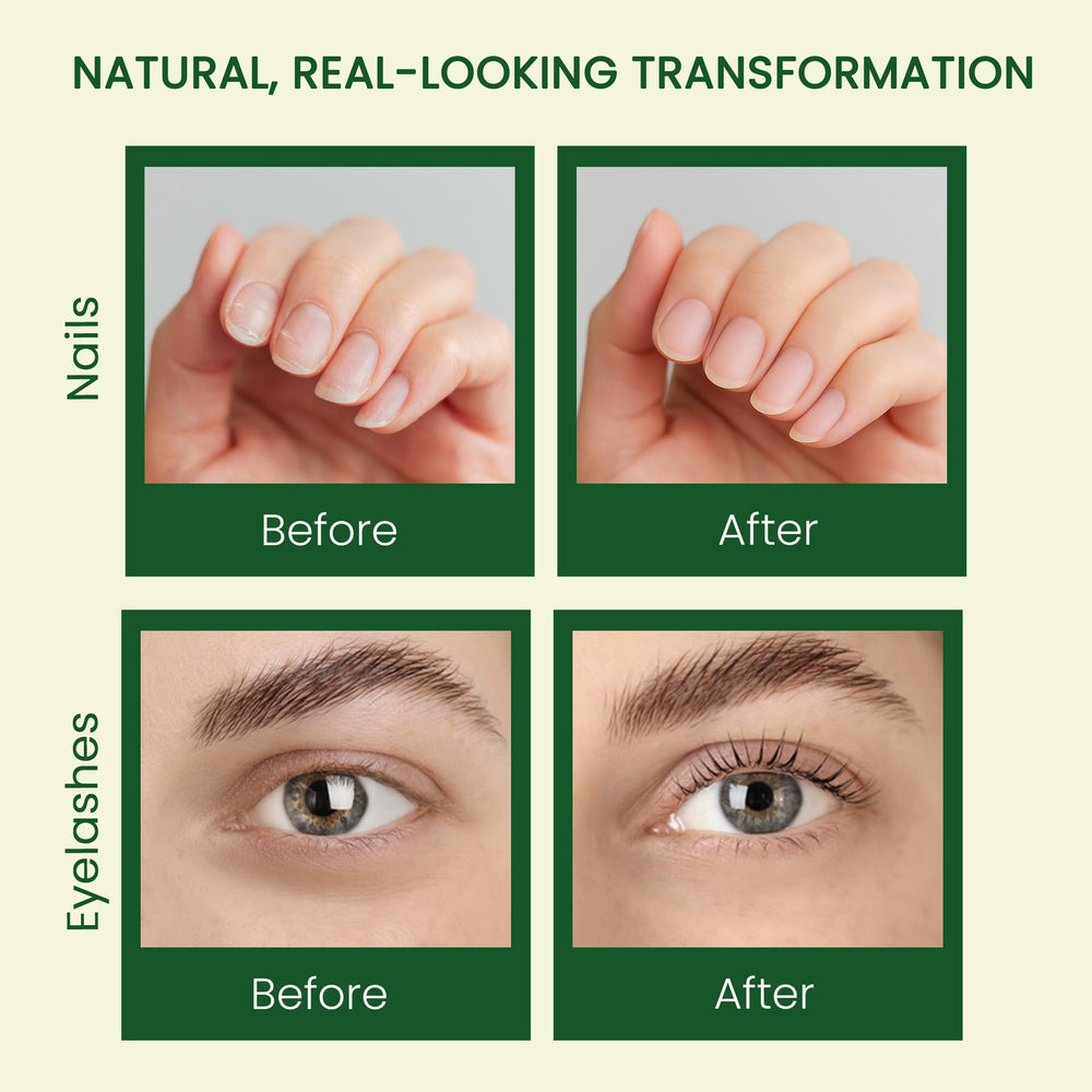 LuxoLook castor oil scalp massager promotes gentle oil distribution.