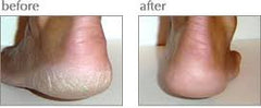 Luxuriant Cracked Heel Repair solid-application tube for targeted heel treatment.