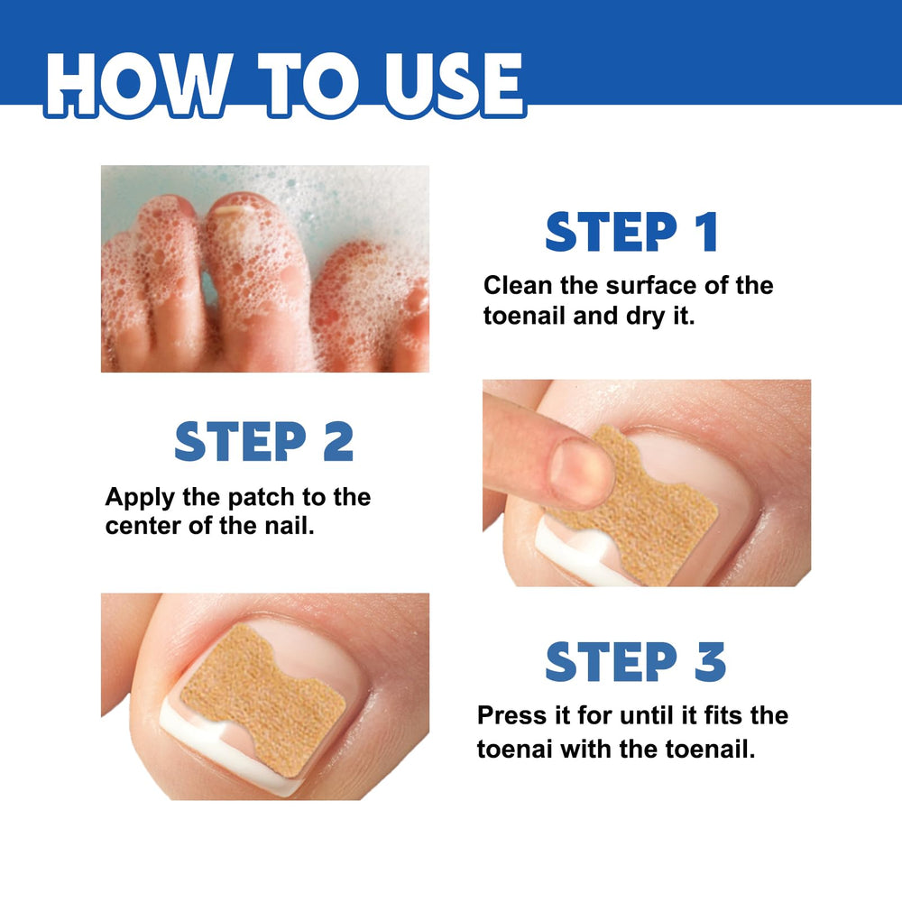 LYFXuGeMLM protective nail cover after toe injury