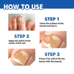 LYFXuGeMLM protective nail cover after toe injury