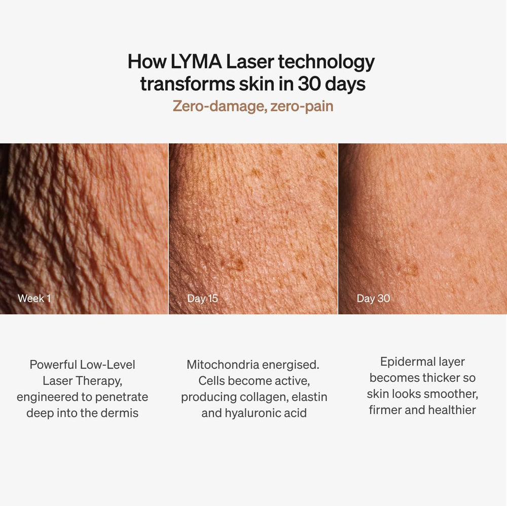 Compact design LYMA Laser Device on countertop