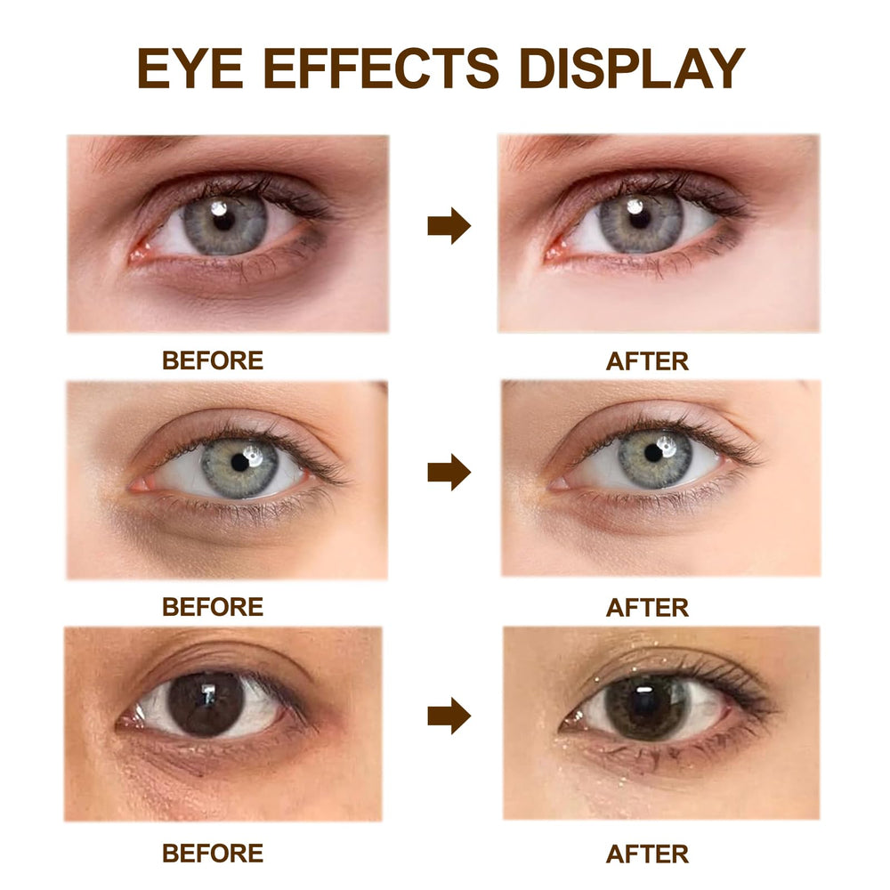 lymznus caffeine eye cream provides anti-aging care for the eye area