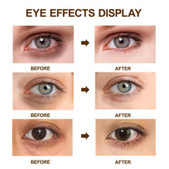 lymznus caffeine eye cream provides anti-aging care for the eye area