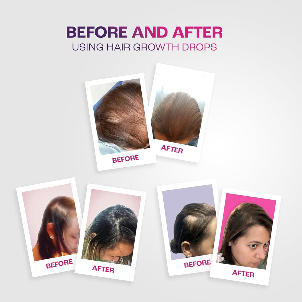 Maka Capilar Health visuals show healthier scalp appearance