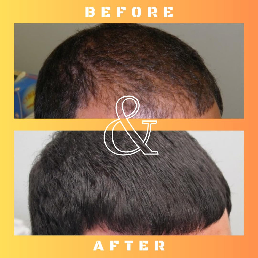 Mane Regain convenient 30 ml bottle for consistent ongoing use