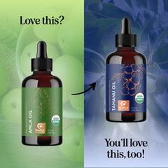 Maple Holistics Amla Oil in use showing scalp massage benefit.