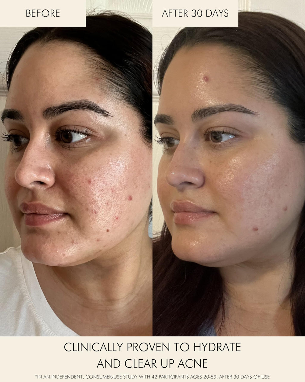 MARA All skin types may benefit from clarified pores and hydration.