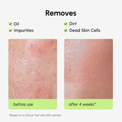 MAREE Exfoliating Toner texture on skin shows gentle, fast-absorbing application.