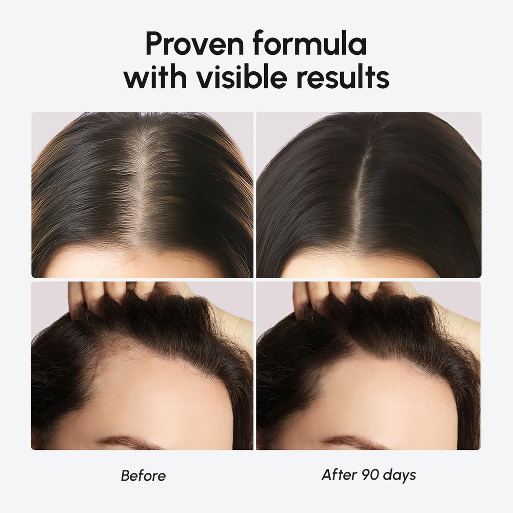 MAREE scalp serum application demonstrates easy daily use.