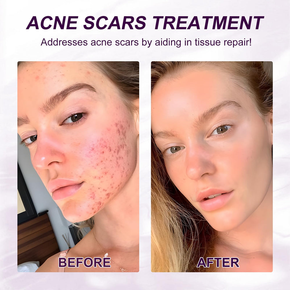 Marianp serum texture closeup highlighting lightweight hydration