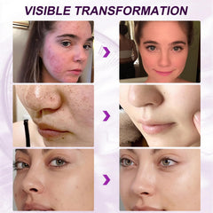 Marianp serum travel size bottle ready for on-the-go skincare