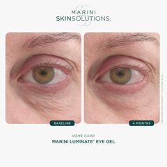 Marini SkinSolutions Luminate Eye Gel under-eye application scene