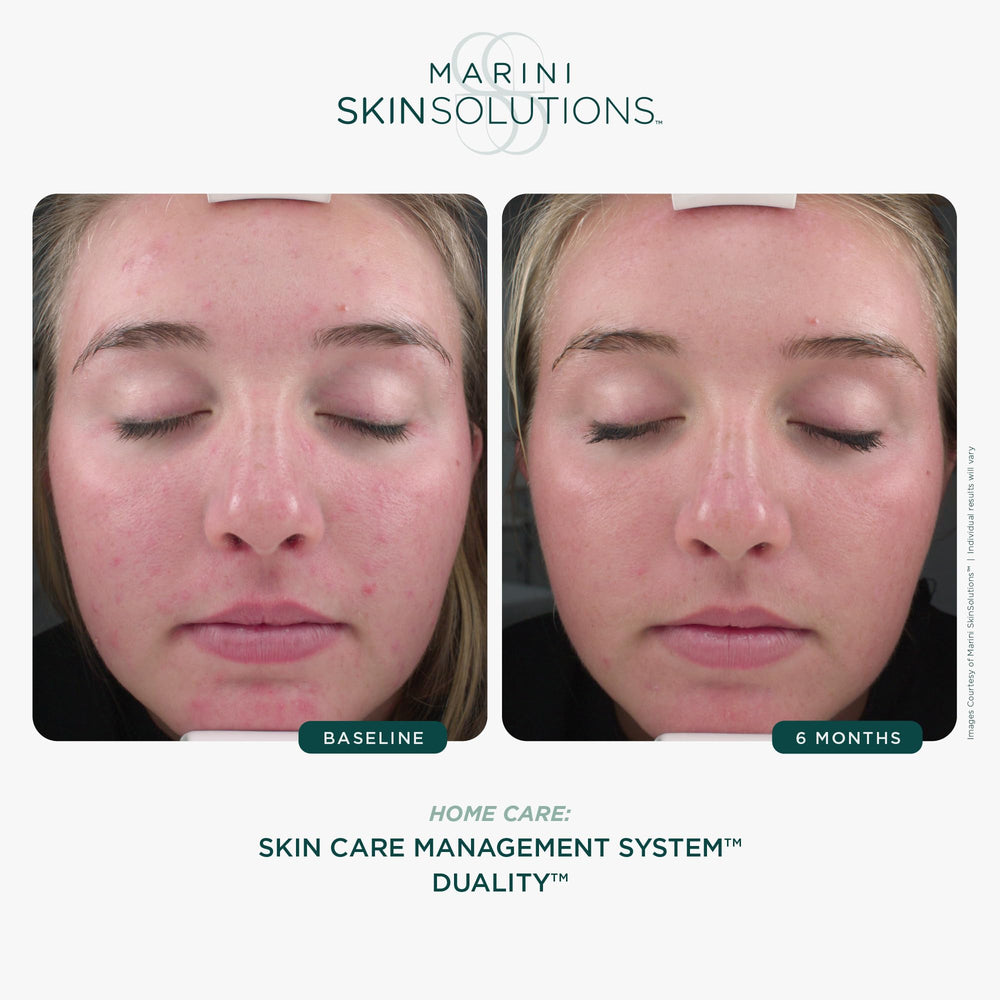 Marini SkinSolutions Duality cream texture closeup shows lightweight formula for quick absorption