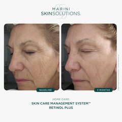 Marini SkinSolutions Retinol Plus bottle highlighting ingredients green tea for soothing antioxidants.