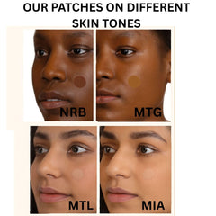 MATCHED medium patch 0.4 inch suitable for moderate spots.