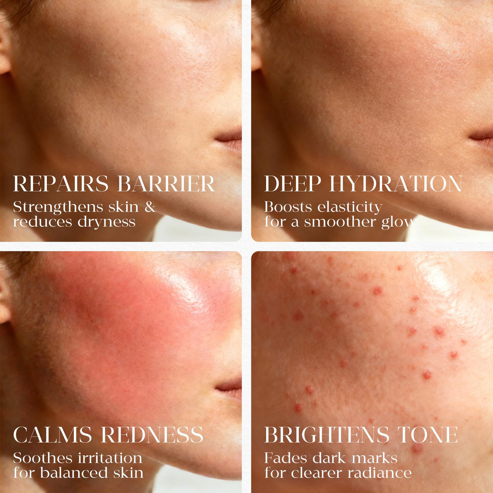 MATRÚM formula calms redness on sensitive skin during use.