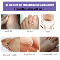 Mckkymi foot mask applied on feet demonstrating easy at-home spa use