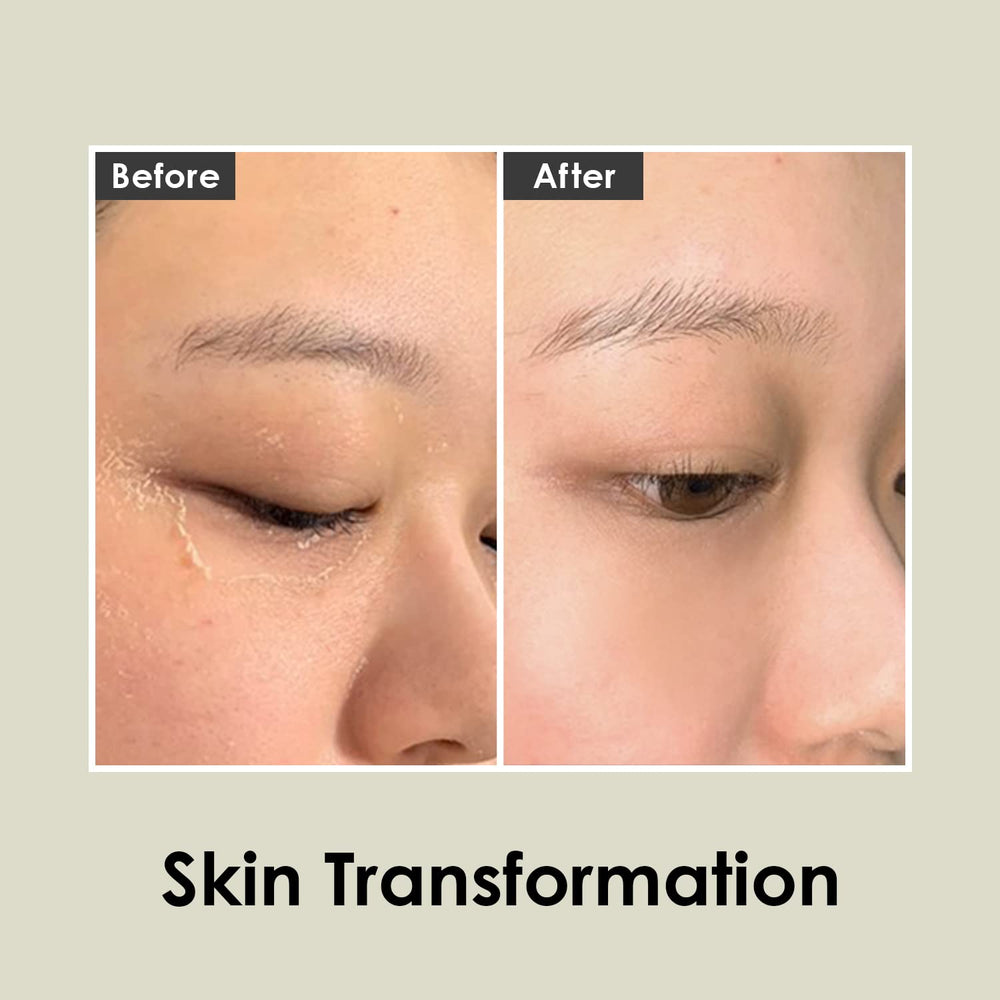 MEDI-PEEL Herbal Peel Tox texture swatch hints at creamy exfoliating action.