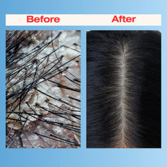 Mediceuticals Therapro application scene shows step-by-step use at sink